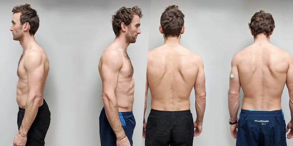 Το «πείραμα» των διδύμων: Ο ένας έγινε vegan και ο άλλος έτρωγε κρέας για 12 εβδομάδες runbeat.gr